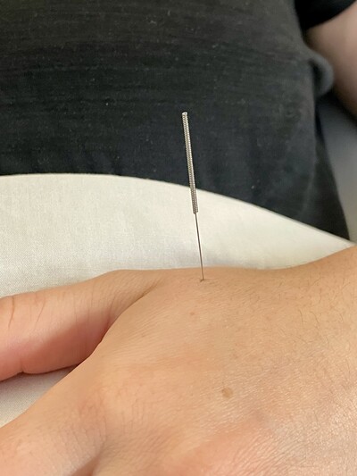 Link to: /pages/tcm-acupuncture