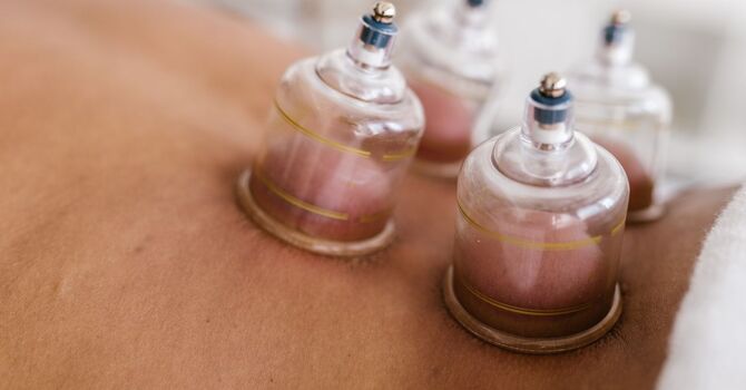What Is Cupping Therapy and What Can It Do for Your Body?