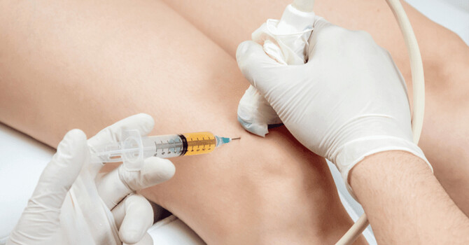 Regenerative Medicine